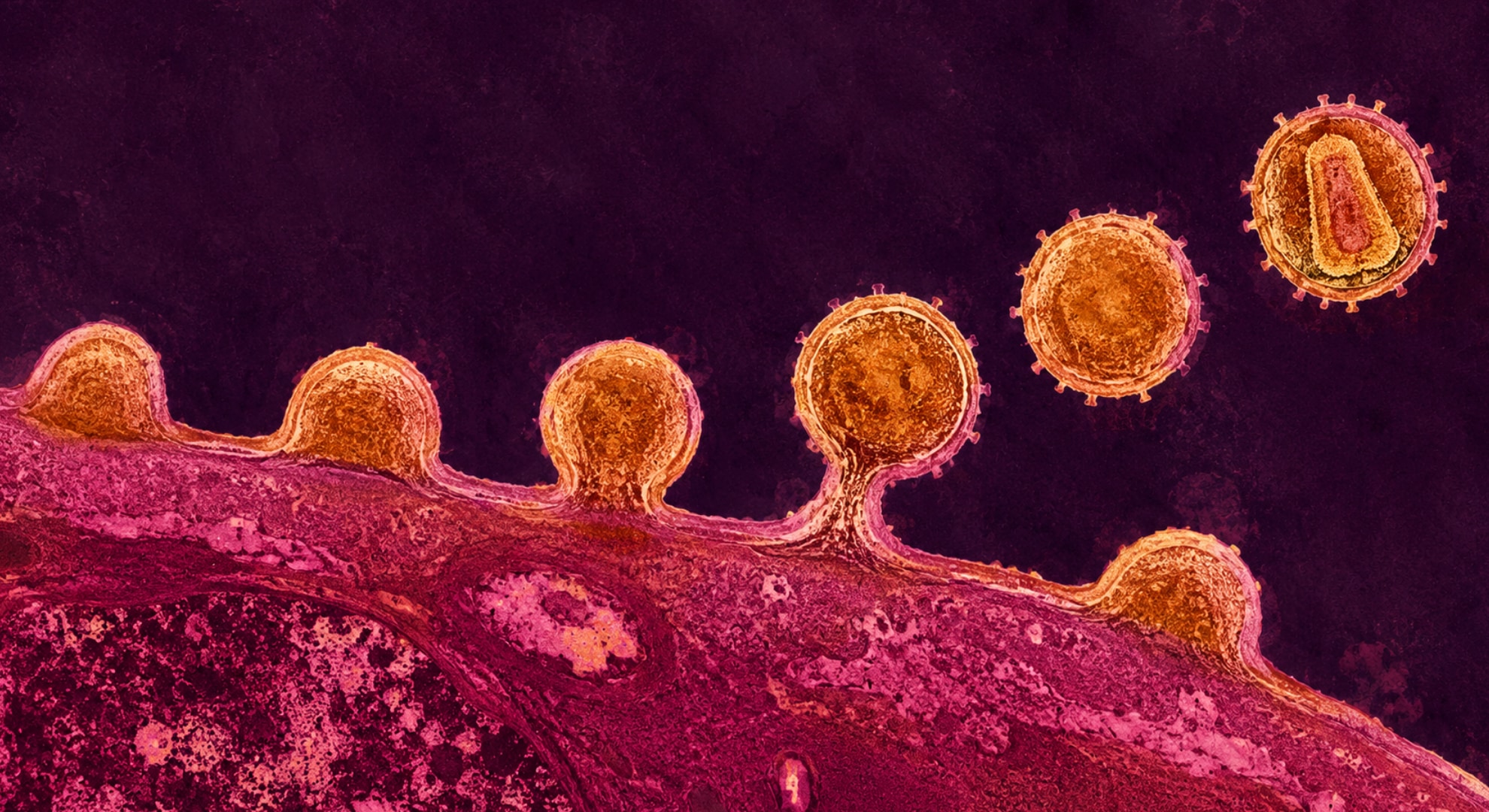 HIVが「一生モノ」であり続けてきた理由