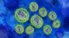 実験的治療でHIVが消失した——三つ揃えて初めて起きた逆転