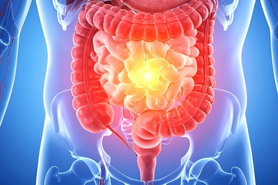 世界で最も飲まれる糖尿病薬は腸を「糖の浪費家」にしていた