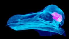 世界に2つしかない完全な頭骨が、CTにかけられた