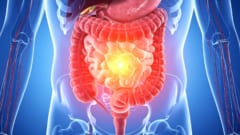 世界で最も飲まれる糖尿病薬は腸を「糖の浪費家」にしていた