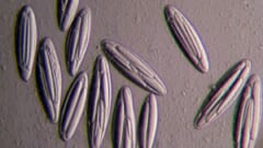 人間の腸にも「巨大細菌」が潜んでいる可能性がある