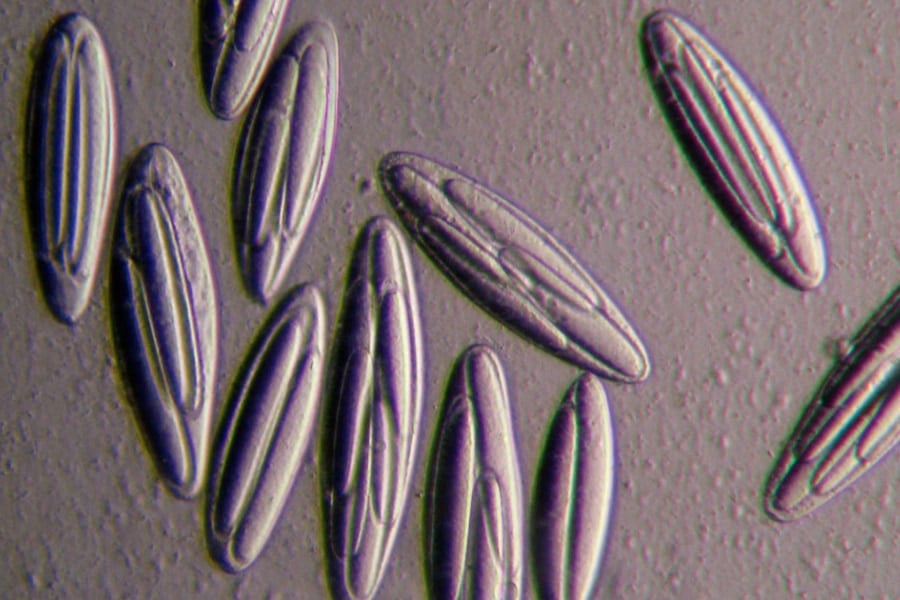 人間の腸にも「巨大細菌」が潜んでいる可能性がある