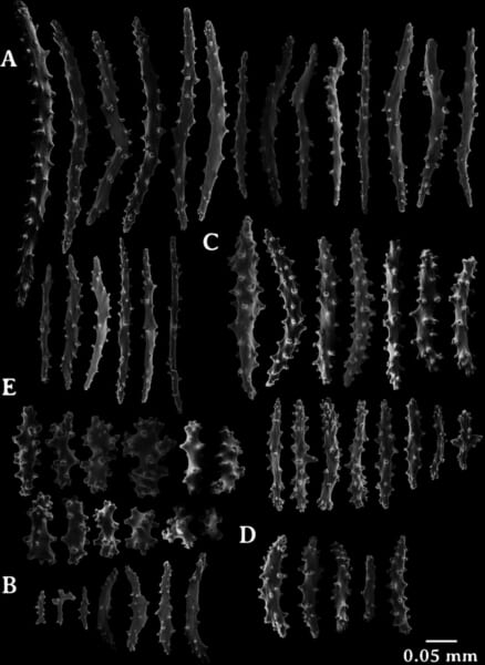 新種の基準になった標本の骨片を、電子顕微鏡で写したものです。ポリプの頭の部分にある紡錘形(両端が細い形)の骨片や、ポリプにある棒の形の骨片などが並んでいます。
