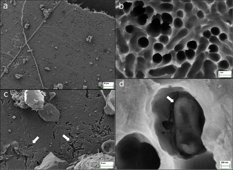 プラスチックを食べた酵素の「もう1つの顔」とは?
