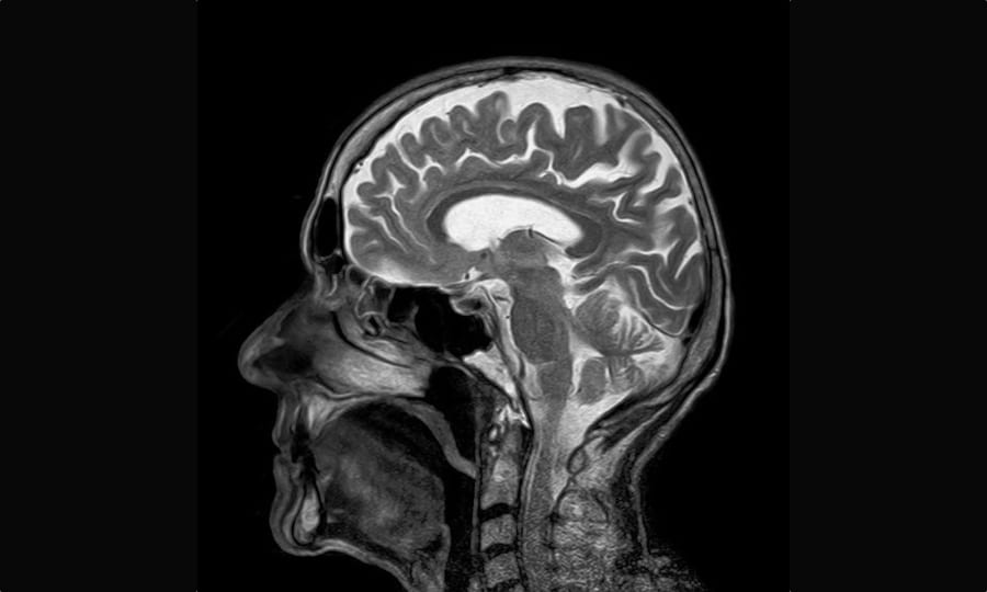 中国の科学者が「魂」を観測できる脳内スキャナーを開発中