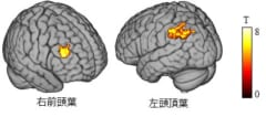 「世界が色あせて見える」現象は脳のせいだった。現実感がなくなる脳の仕組みを発見の画像 4/4