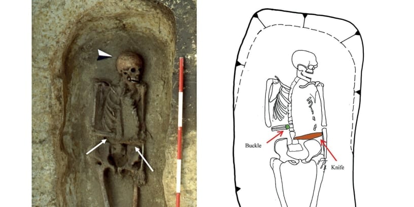 右腕を「刃の義手」にした中世イタリアの戦士の遺体