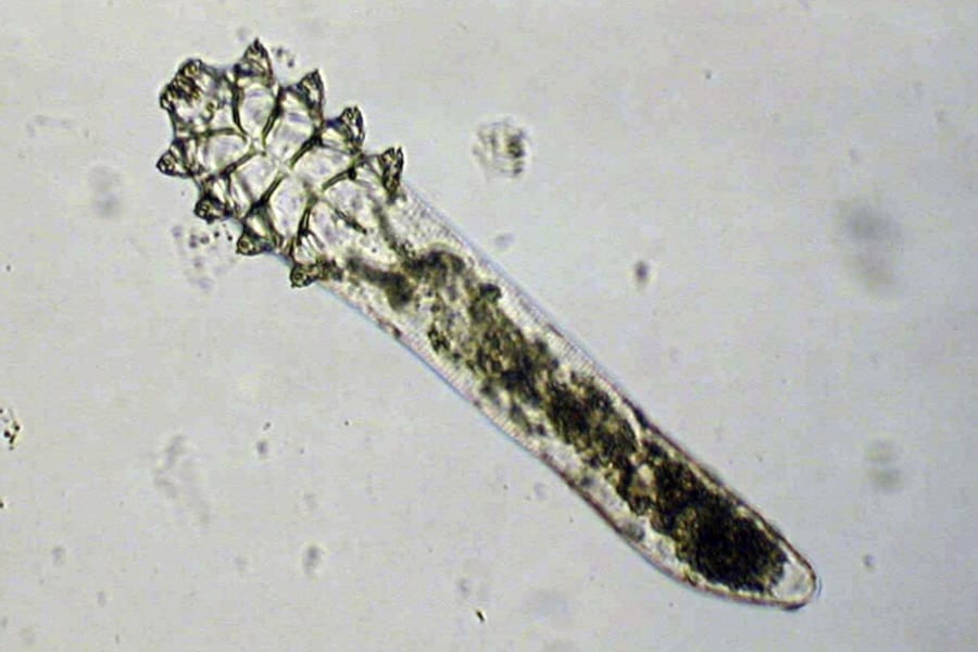 顔ダニは「人体との融合」に向けて進化し始めていた！