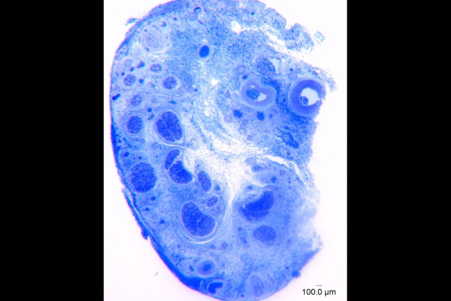 人間のクリトリスの神経線維をガチで数えた研究「1万本以上あった」