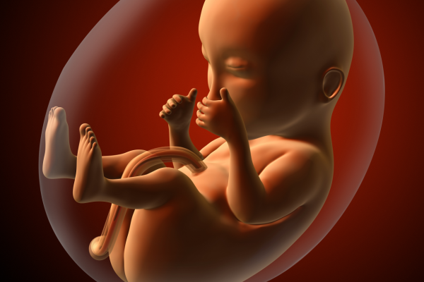 1歳女児の頭蓋内から「未発達の胎児」が摘出された異例のケース