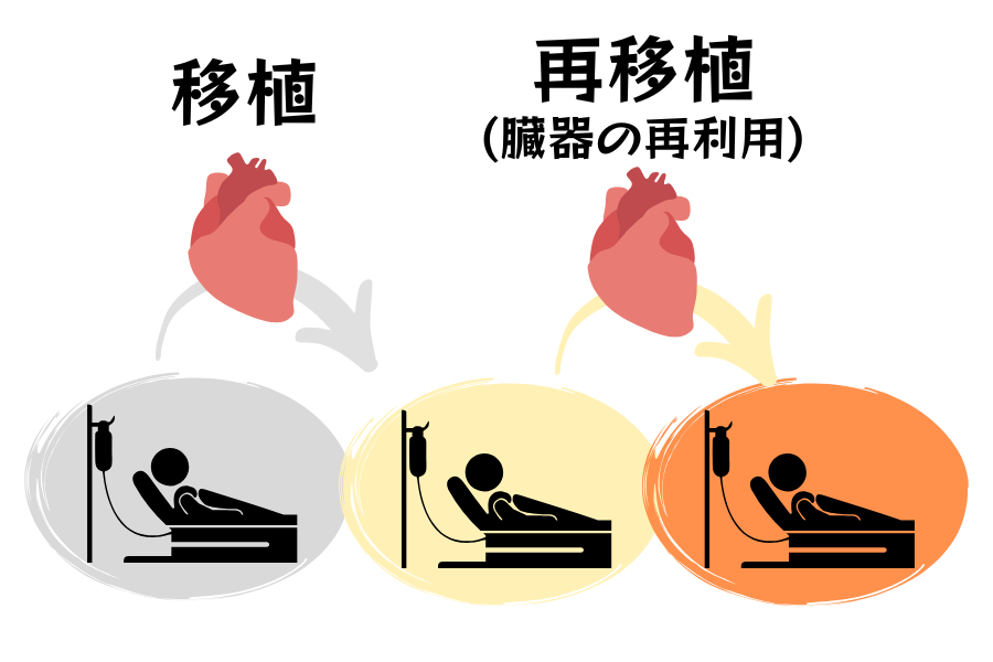 移植された臓器を「別の人へ再び移植」できるのか？