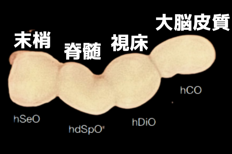 脳オルガノイドを「直列接続」 して痛覚を可視化することに成功