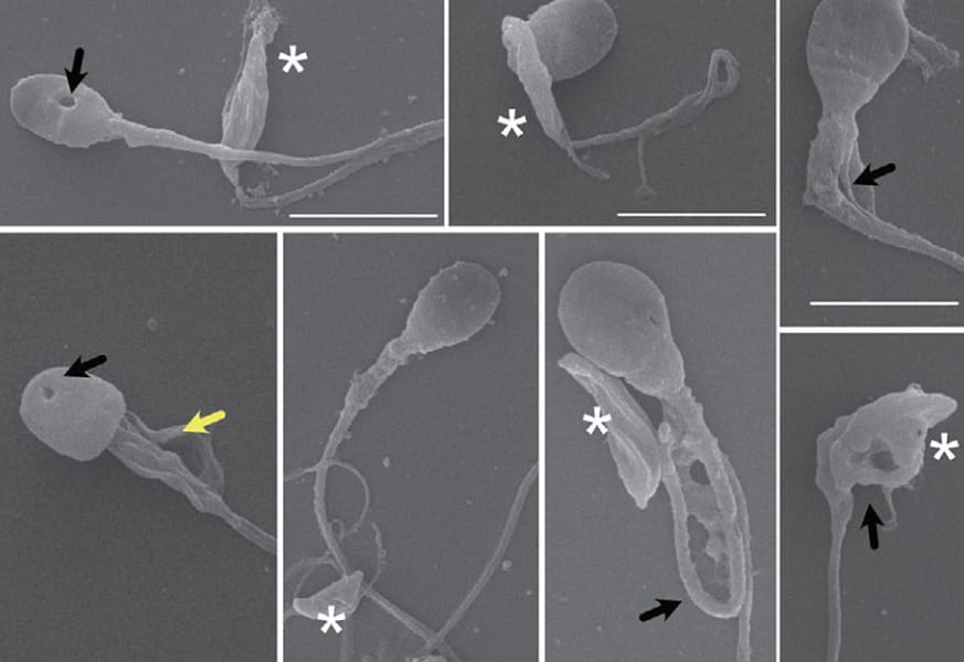 猫の寄生虫は5分で人間の精子の頭を切断できる