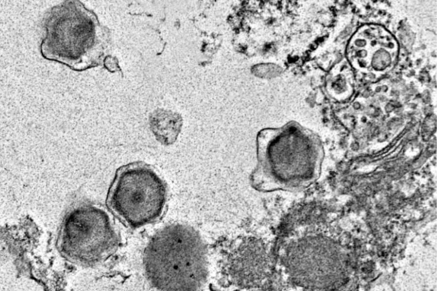 世界各地の海から「未知の巨大ウイルス」230種類を発見