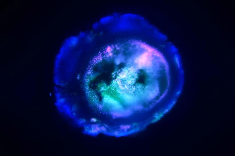 【大脳＋中脳＋後脳】人間の脳全体を模倣した初めての多領域脳オルガノイドを作製
