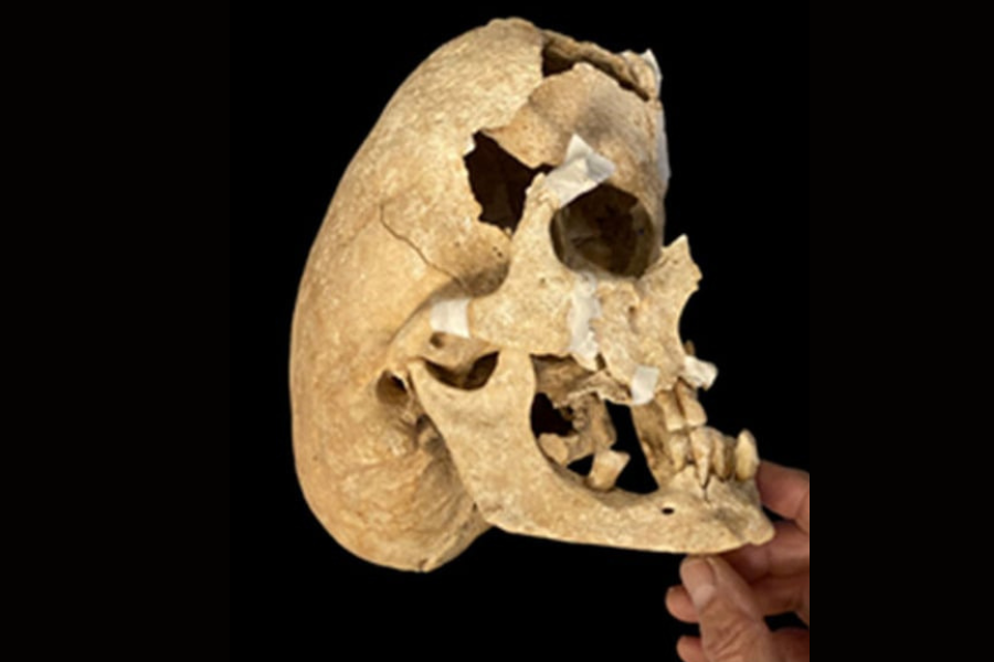 重度の奇形をもつ「中世騎士の頭蓋骨」を発見