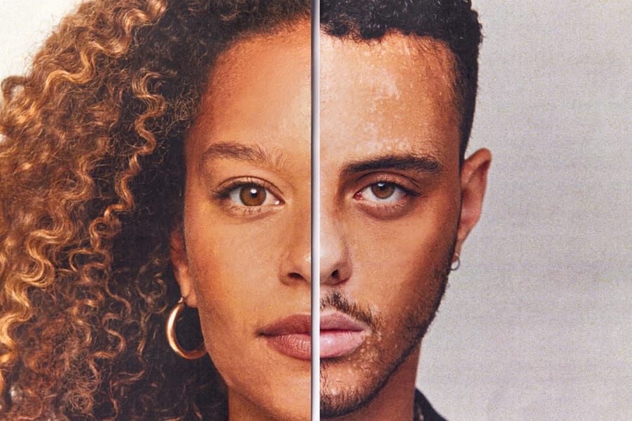 性別違和感と関連する軽度な外見的特徴を発見