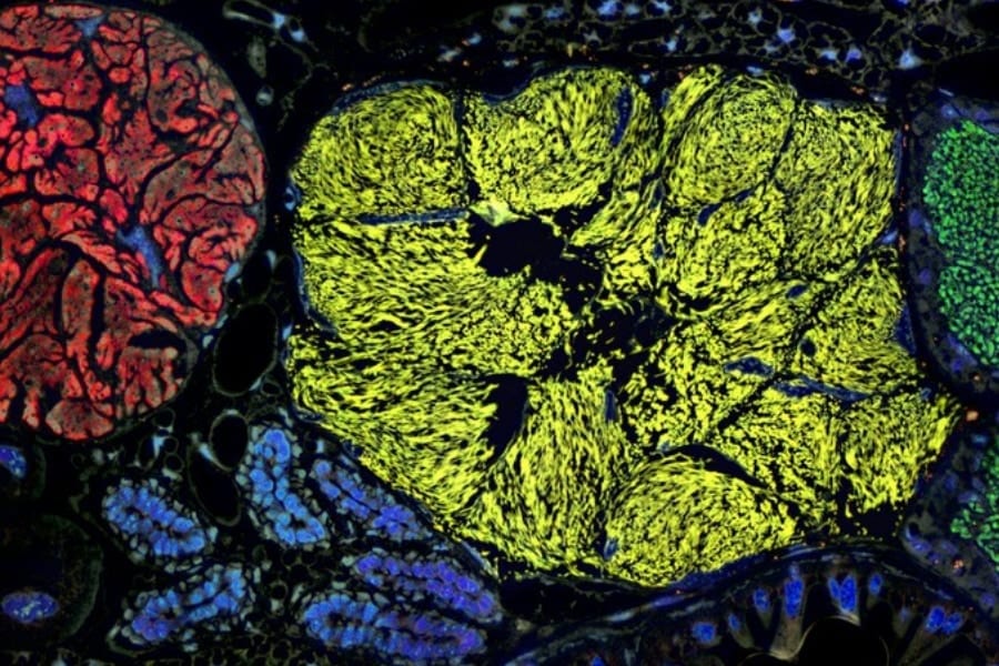 「半分生物で半分細胞部品」のような最小のゲノムを持つ生命体を発見