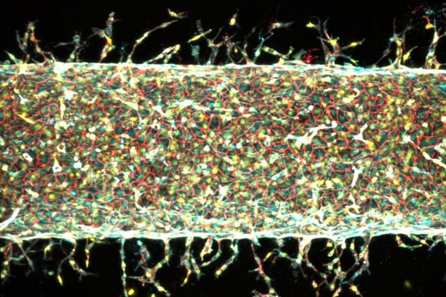 MITが磁石を使って人工血管を培養することに成功