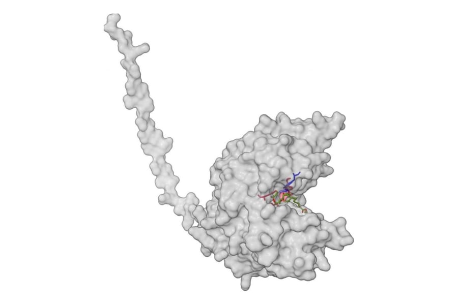 プラスチックを食べる「パックマン酵素」を発見